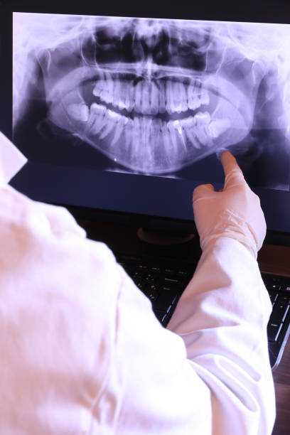 Best Emergency Dentist for Lost Fillings or Crowns in Perry, OK