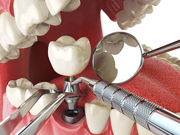 Best Pediatric Emergency Dentist in Perry, OK